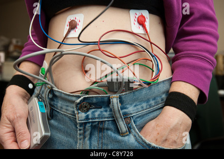 A woman wears a Holter, an ambulatory electrocardiography device, monitors the electrical activity of her cardiovascular system Stock Photo