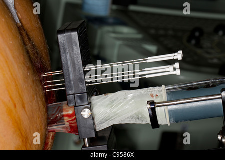 Prostate brachytherapy: Trans-perineal needles in situ for insertion of radioiodine seeds, and rectal ultrasound probe. Stock Photo