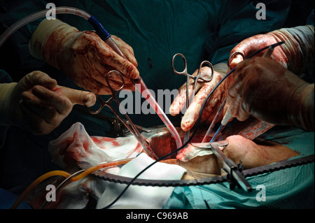 Detail of doctors performing surgery in an operating room Stock Photo