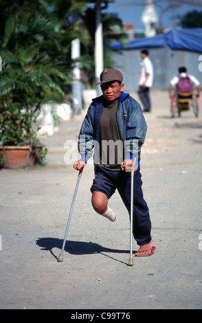 Land mines remain the brutal legacy of years of war in Cambodia. Stock Photo