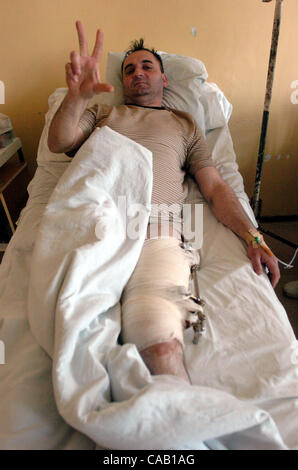Mar 22, 2004; Kosovo, SERBIA; A Serbian at the hospital in Kosovska Mitrovica gives the Serbian salute (with 3 fingers.) He was injured during the latest ethnic cleansing by Albanians. The worst ethnic violence since the 1998-1999 Kosovo war erupted here and spread to other parts of the troubled pro Stock Photo