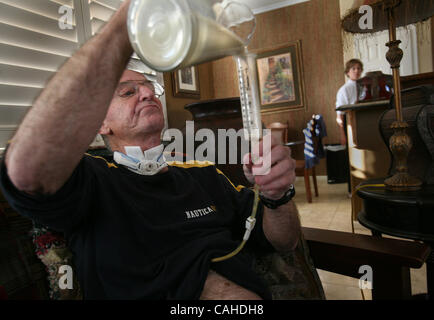 LEDE   Vic Mounts sits at home and feeds himself with a feeding tube that goes directly to the stomach as his wife Toni Mounts looks on in the background of there home. The restaurant is near there home. Vic Mounts communicates with pen a paper in his home writing about his life. Vic Mounts is 68, a Stock Photo