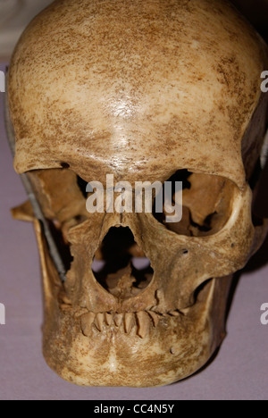 Cut out of Original Human Skull Stock Photo