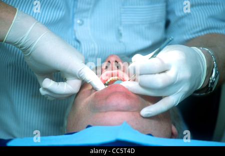 Dentist undertaking check up in surgery, Hounslow, Middlesex, UK. Stock Photo