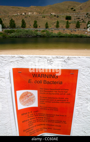 A sign warning of E. coli bacteria in the Sandy Point swimming water at Discovery Park below Lucky Peak Dam, Idaho, USA. Stock Photo