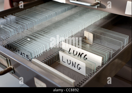 Rows of glass microscope slides ready for use in research in tray organized for scientific research on human lung tissue Stock Photo