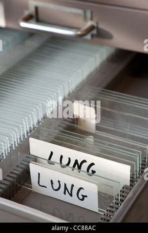 Rows of glass microscope slides ready for use in research in tray organized for scientific research on human lung tissue Stock Photo