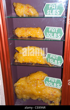 Body Fat Comparison Stock Photo - Alamy