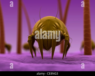 Dust mite. Computer artwork of a house dust mite (Dermatophagoides pteronyssinus) on human skin. Stock Photo