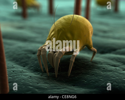 Dust mite. Computer artwork of a house dust mite (Dermatophagoides pteronyssinus) on human skin. Stock Photo