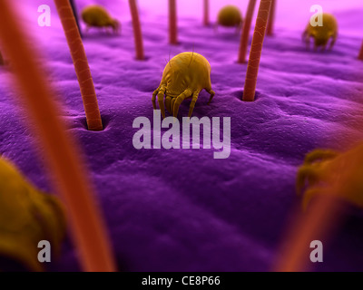 Dust mites. Computer artwork of house dust mites (Dermatophagoides pteronyssinus) on human skin. Stock Photo