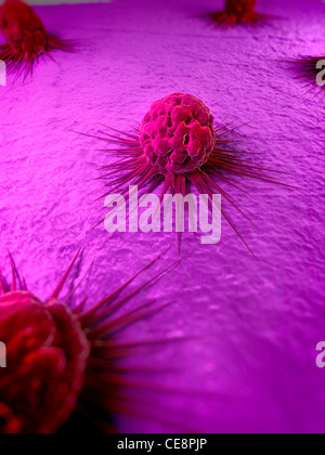 Cancer cells, computer artwork. The uneven surface and cytoplasmic projections are characteristic of cancer cells. Stock Photo