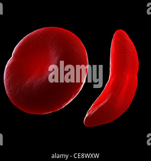 Sickle cell anaemia, computer artwork. Stock Photo