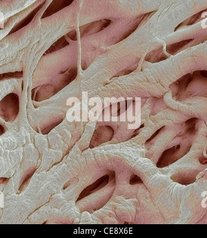 Heart strings coloured scanning electron micrograph SEM heart strings chordae tendineae are cord-like tendons connect papillary Stock Photo