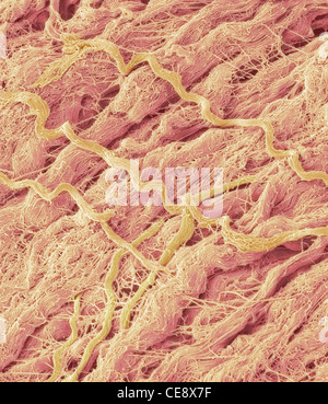 Dense connective tissue coloured scanning electron micrograph SEM main component tissue collagen Magnification x1500 when Stock Photo