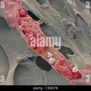 Ruptured venule Coloured scanning electron micrograph SEM ruptured venule running through fatty tissue  Stacked red blood cells Stock Photo