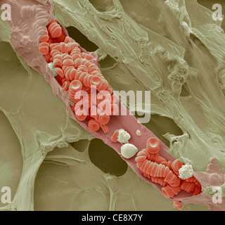 Ruptured venule Coloured scanning electron micrograph SEM ruptured venule running through fatty tissue  Stacked red blood cells Stock Photo