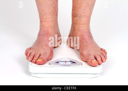 https://l450v.alamy.com/450v/ceetfx/mature-mans-feet-on-scale-as-he-takes-his-weight-measurement-with-ceetfx.jpg