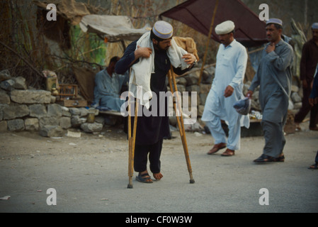 hurt by a mine, a common sight in Afghanistan Stock Photo