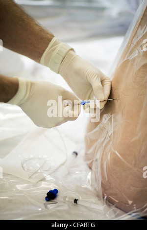 36 year old woman about to give birth receiving an epidural, Chateauguay, Quebec, Canada Stock Photo