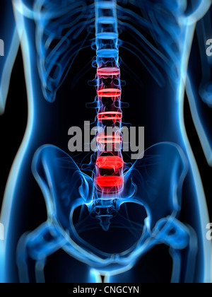 Back pain  conceptual artwork Stock Photo