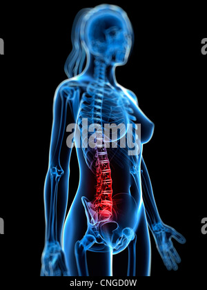 Back pain  conceptual artwork Stock Photo
