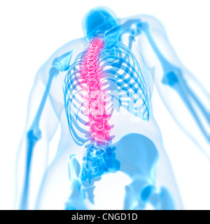 Back pain  conceptual artwork Stock Photo