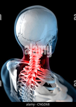 Neck pain  conceptual artwork Stock Photo