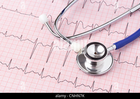Photo of an electrocardiogram ECG or EKG printout with stethoscope Stock Photo