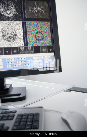 A computer with MRI scans on it Stock Photo