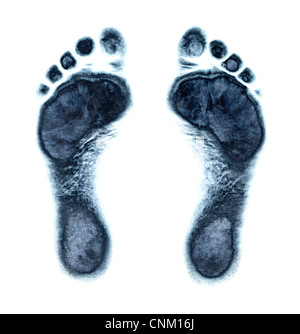 Feet from below, foot prints Stock Photo