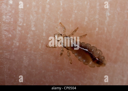 head louse (Pediculus capitis, Pediculus humanus capitis, Pediculus humanus), louse on human skin, Germany Stock Photo