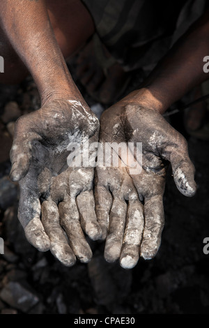 Hand of coal collector in Jharia, Dhanbad, Jharkhand, India Stock Photo