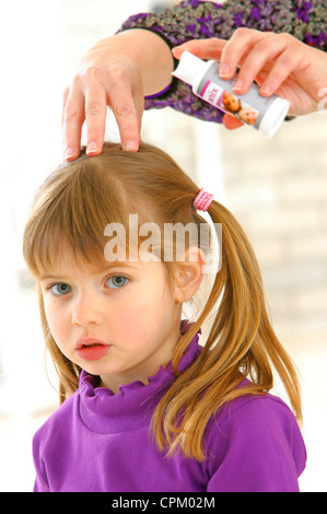 TREATMENT FOR LICE Stock Photo