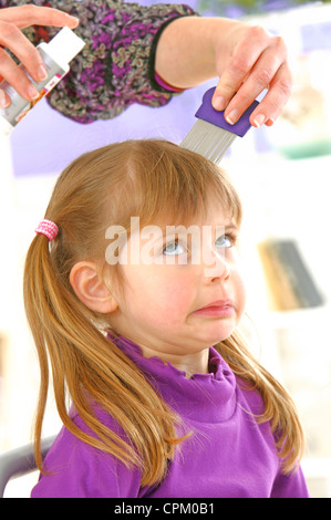 TREATMENT FOR LICE Stock Photo