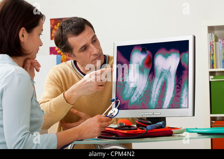 TOOTH  DECAY, X-RAY Stock Photo