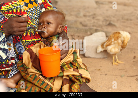 Abibata Ouattara, who doesn't know her age, feeds therapeutic milk to her 13-month-old daughter Alimata, malnourished Stock Photo