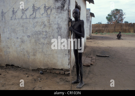 A Dinka boy barely able to stand due to starvation at Thiet feeding camp in Southern Sudan. Stock Photo