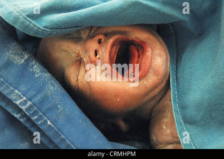 Close up of face of a new born baby soon after birth. Stock Photo