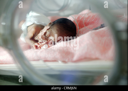 A 5 day old baby born premature at 31 weeks weighing 1kg. The baby is suffering with respiratory distress syndrome and jaundice. Stock Photo