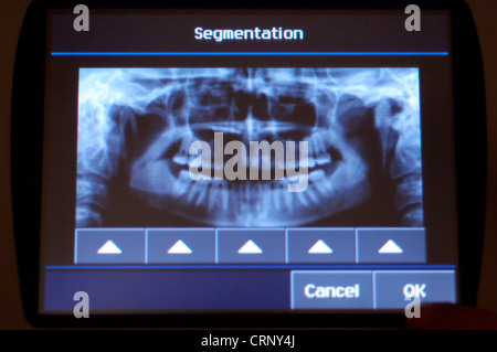 An x-ray image of a human jaw and teeth. Stock Photo