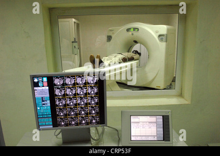 A patient undergoes a CT (Computer Tomography) scan - Control screen of a CT scan (foreground) CT Scanner with patient (background). Stock Photo