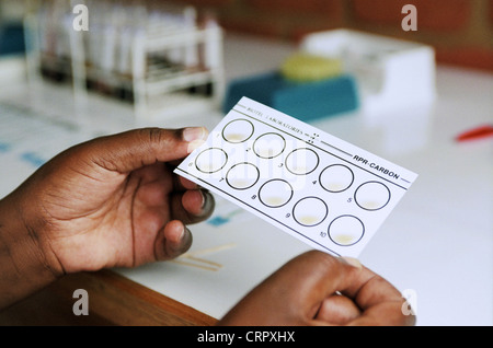 AIDS test strip Stock Photo