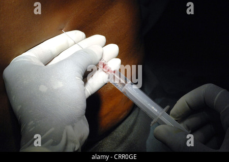 Patient receiving an epidural Stock Photo