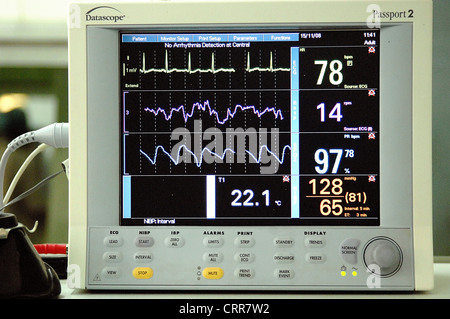 Close-up of a heart monitor visual display unit. Stock Photo