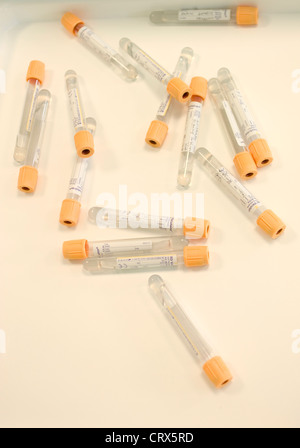 Kidney disease blood containers Stock Photo - Alamy