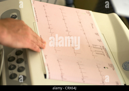 An electrocardiogram recording of a patients cardiac cycle produced by an electrocardiograph Stock Photo
