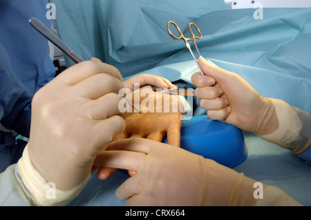 A surgeon preparing to operate on a patient's hand. Stock Photo