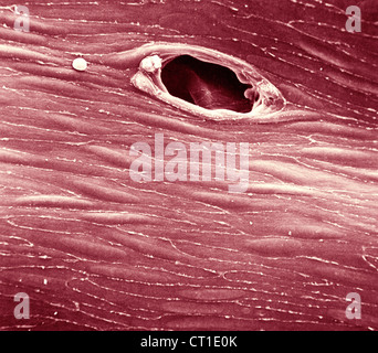 ENDOTHELIUM RABBIT, SEM Stock Photo