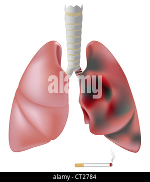 Healthy Lung and Smokers Lung Stock Photo - Alamy